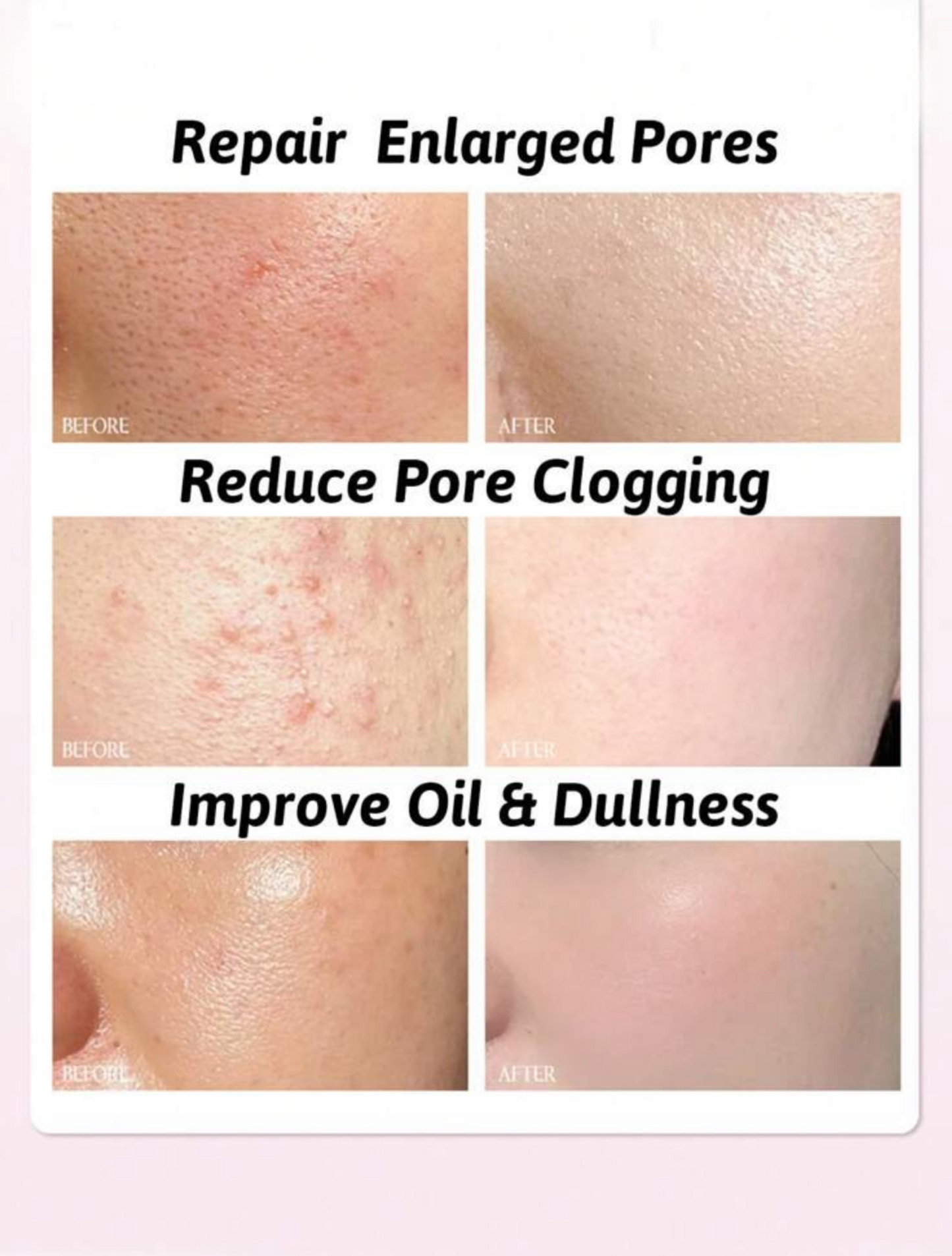Glycolic Acid Liquid Exfoliator 250ml